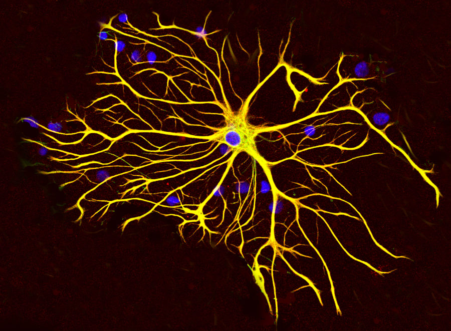 Astrocytes are a type of star-shaped brain cell that supports neuron function by providing energy to neurons and supporting neurotransmission.