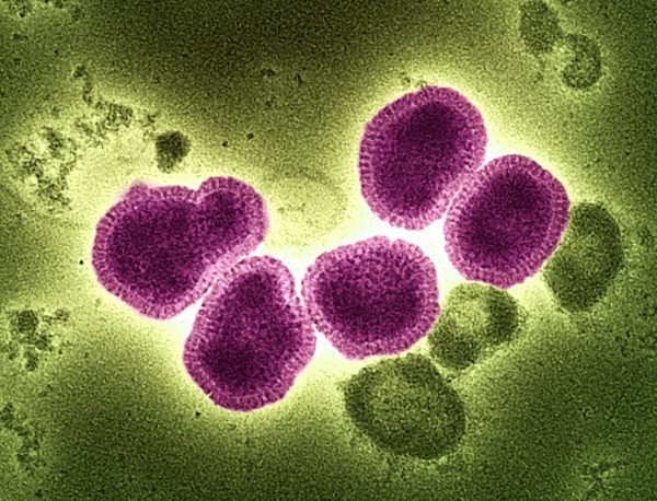 Scientists discover first-ever vampire virus latched to neck of ‘MindFlayer.